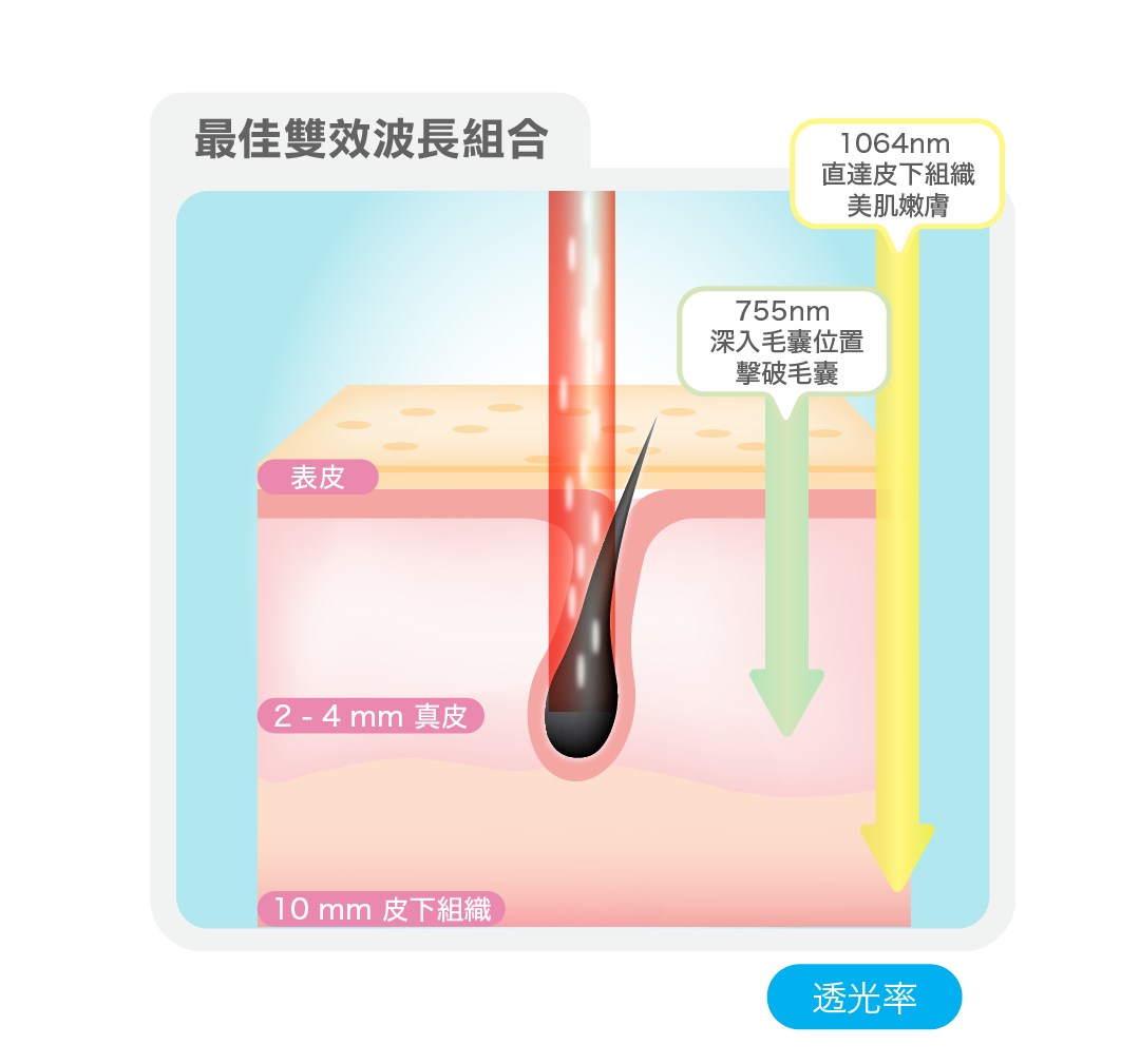 激光脫毛最佳雙效波長組合 – 755nm 及 1064nm